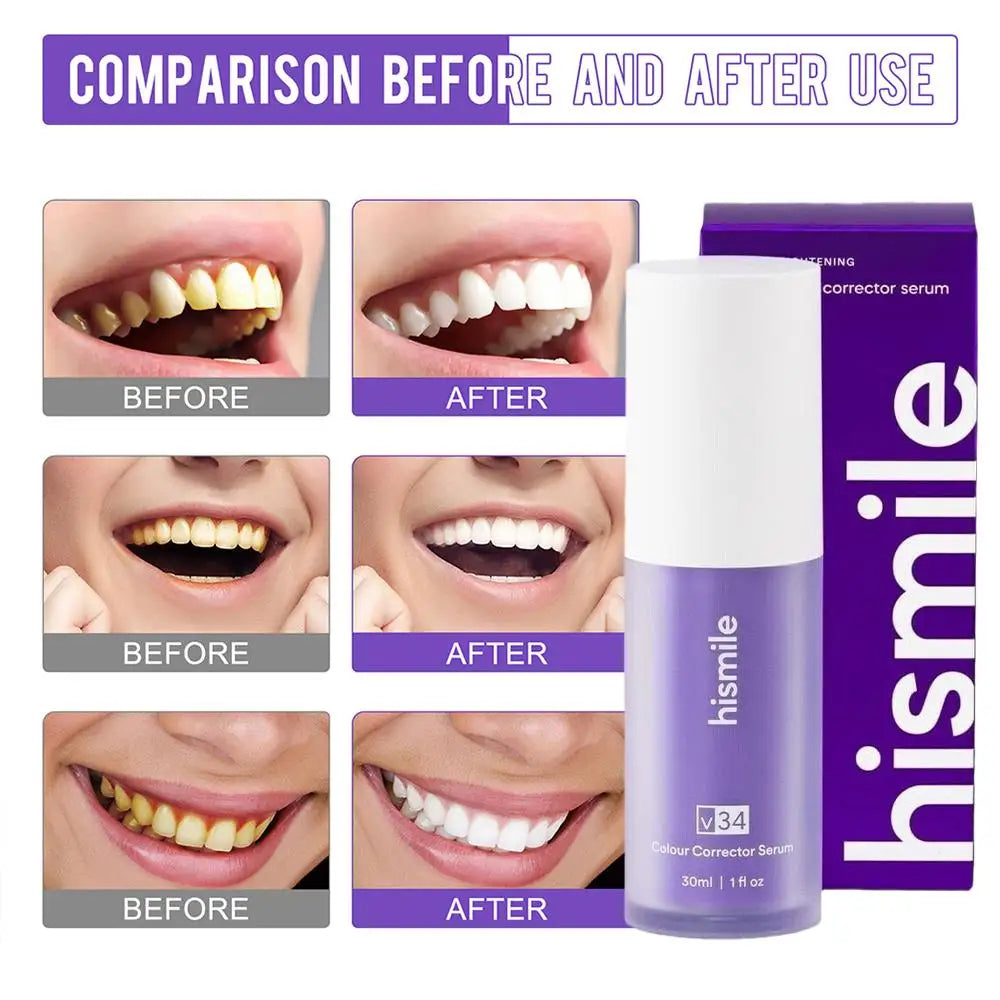 Hismile V34 Colour Corrector Serum (30ml)